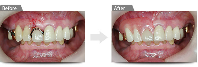 ビフォアー アフター