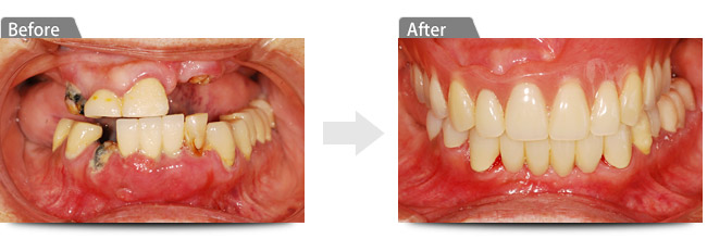 ビフォアー アフター