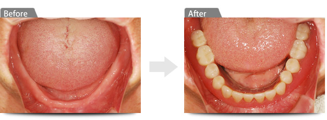 ビフォアー アフター