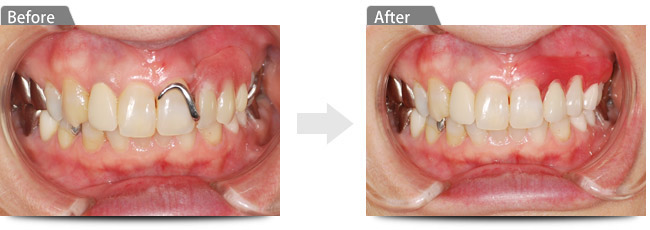 ビフォアー アフター