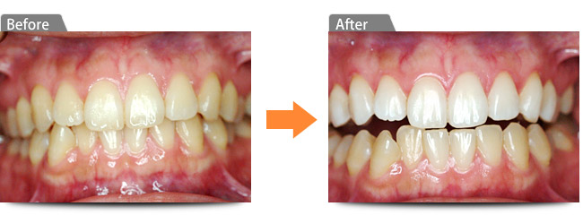 ビフォアー アフター