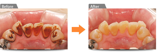 ビフォアー アフター