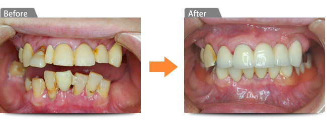 ビフォアー アフター