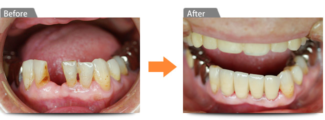 ビフォアー アフター