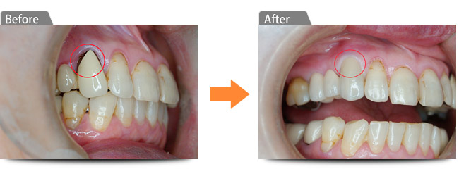 ビフォアー アフター