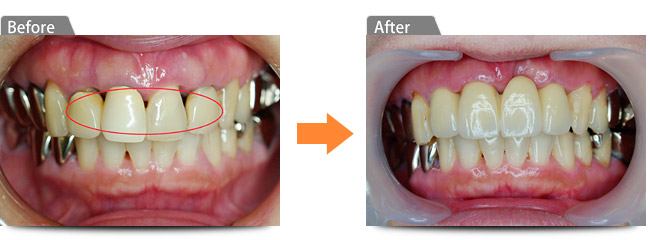 ビフォアー アフター