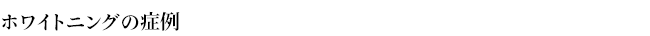 ホワイトニングの症例