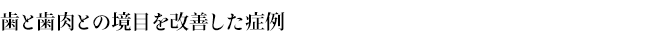 歯と歯肉との境目を改善した症例