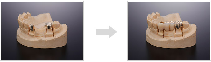 コーヌスクローネ