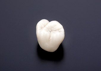 セラミック(奥歯)